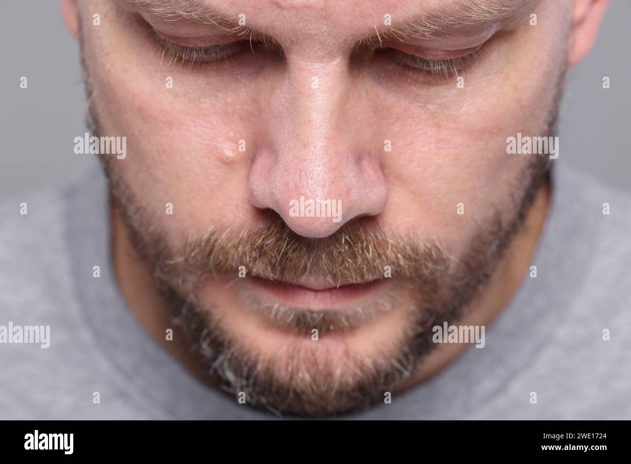 Closeup view of man with normal skin on grey background Stock Photo - Alamy