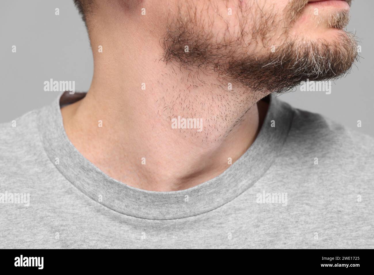 Normal grey hi-res stock photography and images - Alamy