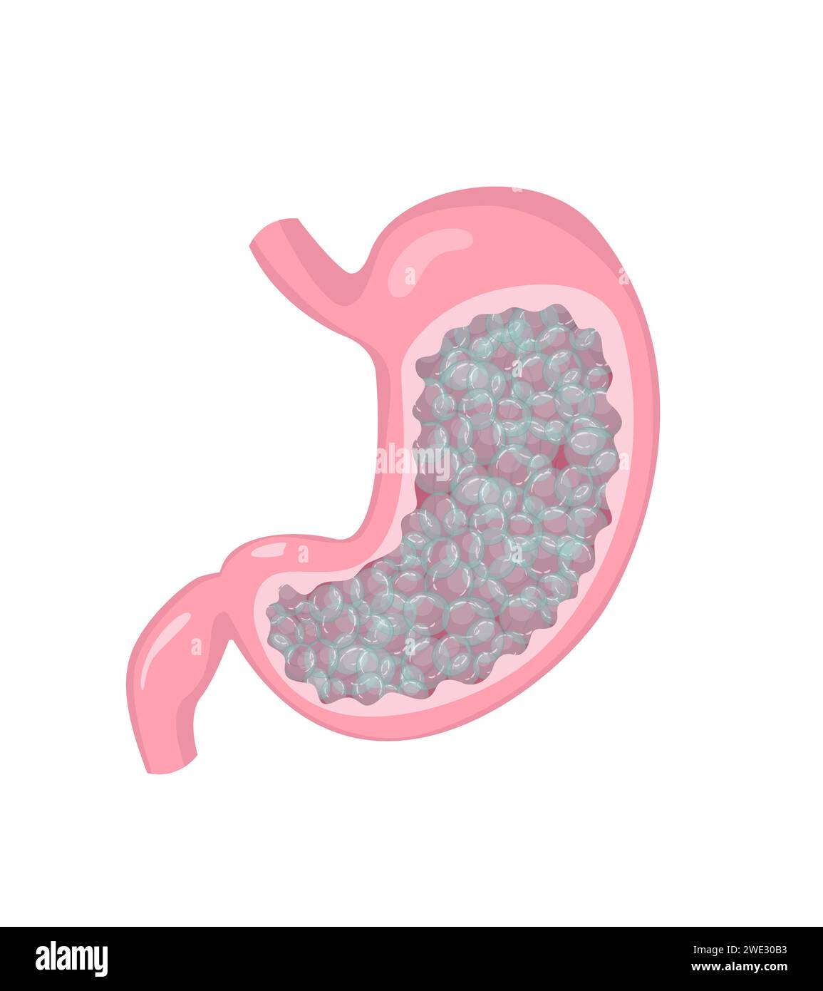 Stomach with gas and bloating feeling. Human internal organ disorder