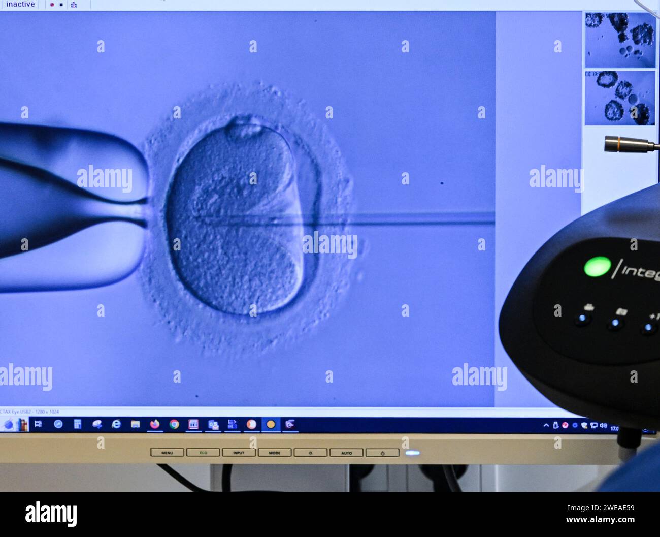 PRODUCTION - 17 January 2024, Berlin: In the cell laboratory at the Fertility Center Berlin, an electron microscope is used to fertilize an egg cell. Photo: Jens Kalaene/dpa Stock Photo