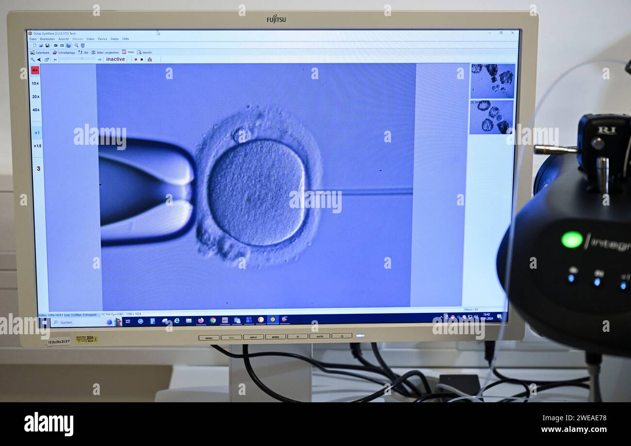PRODUCTION - 17 January 2024, Berlin: In the cell laboratory at the Fertility Center Berlin, an electron microscope is used to fertilize an egg cell. Photo: Jens Kalaene/dpa Stock Photo