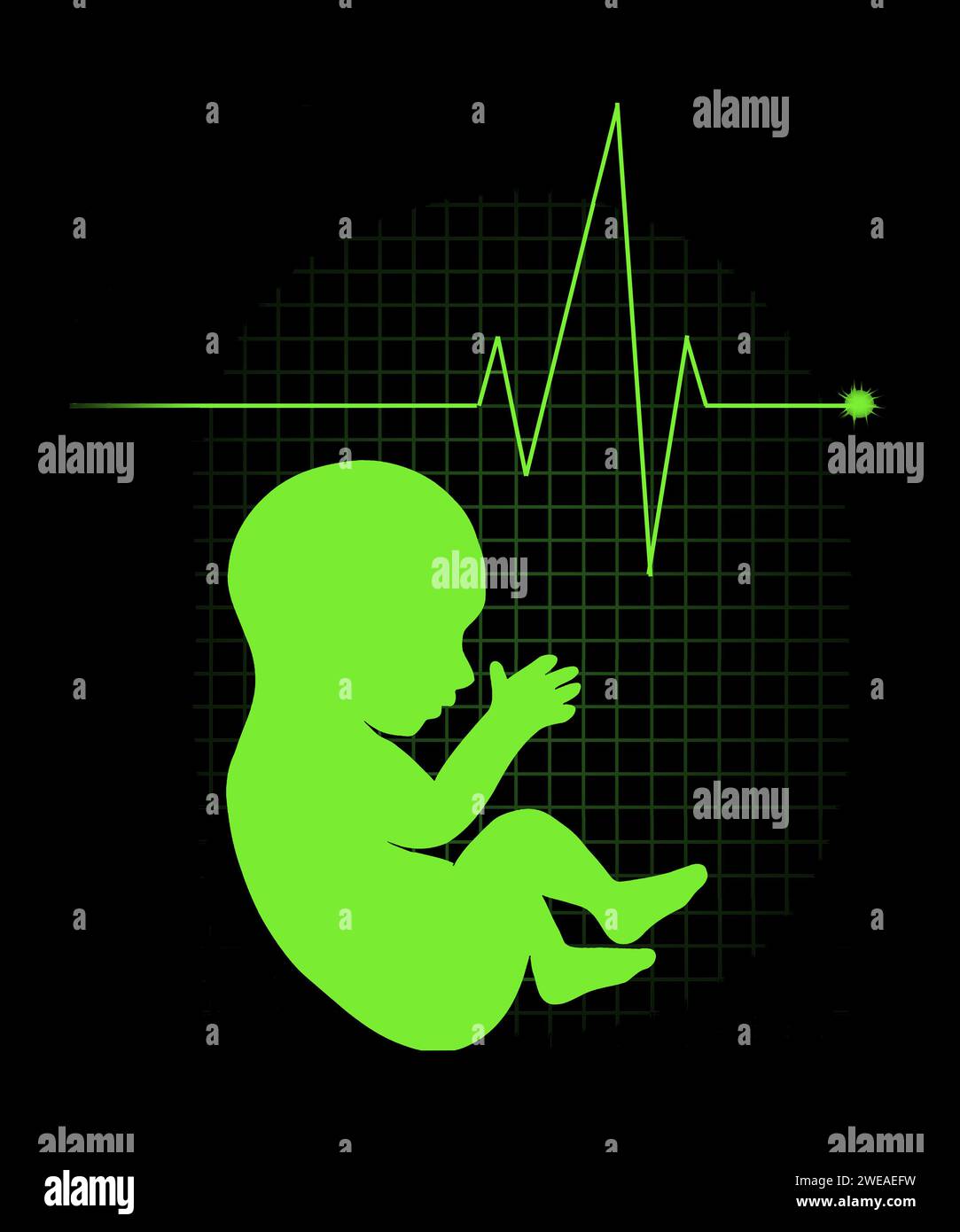 A human fetus and an EKG heartbeat chart are seen in an illustration ...
