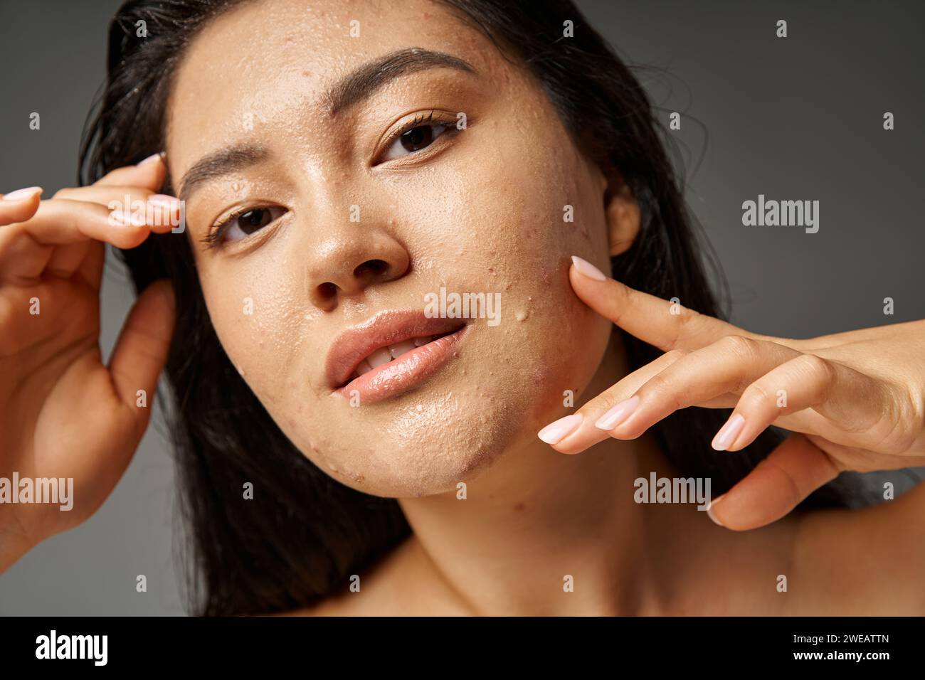portrait of young asian woman with hair and acne on wet face