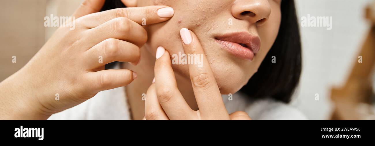 Pimple Correct Acne Clearing Gel Pen - Hero Cosmetics | Ulta Beauty