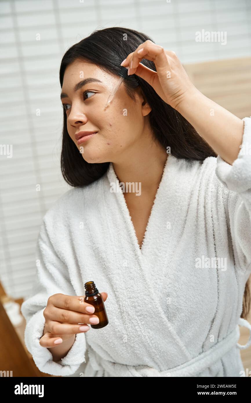Treat Acne On Face