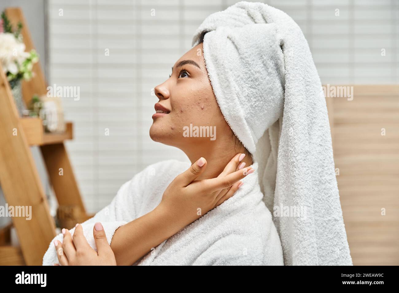 pleased young asian woman with acne prone skin with white towel on head