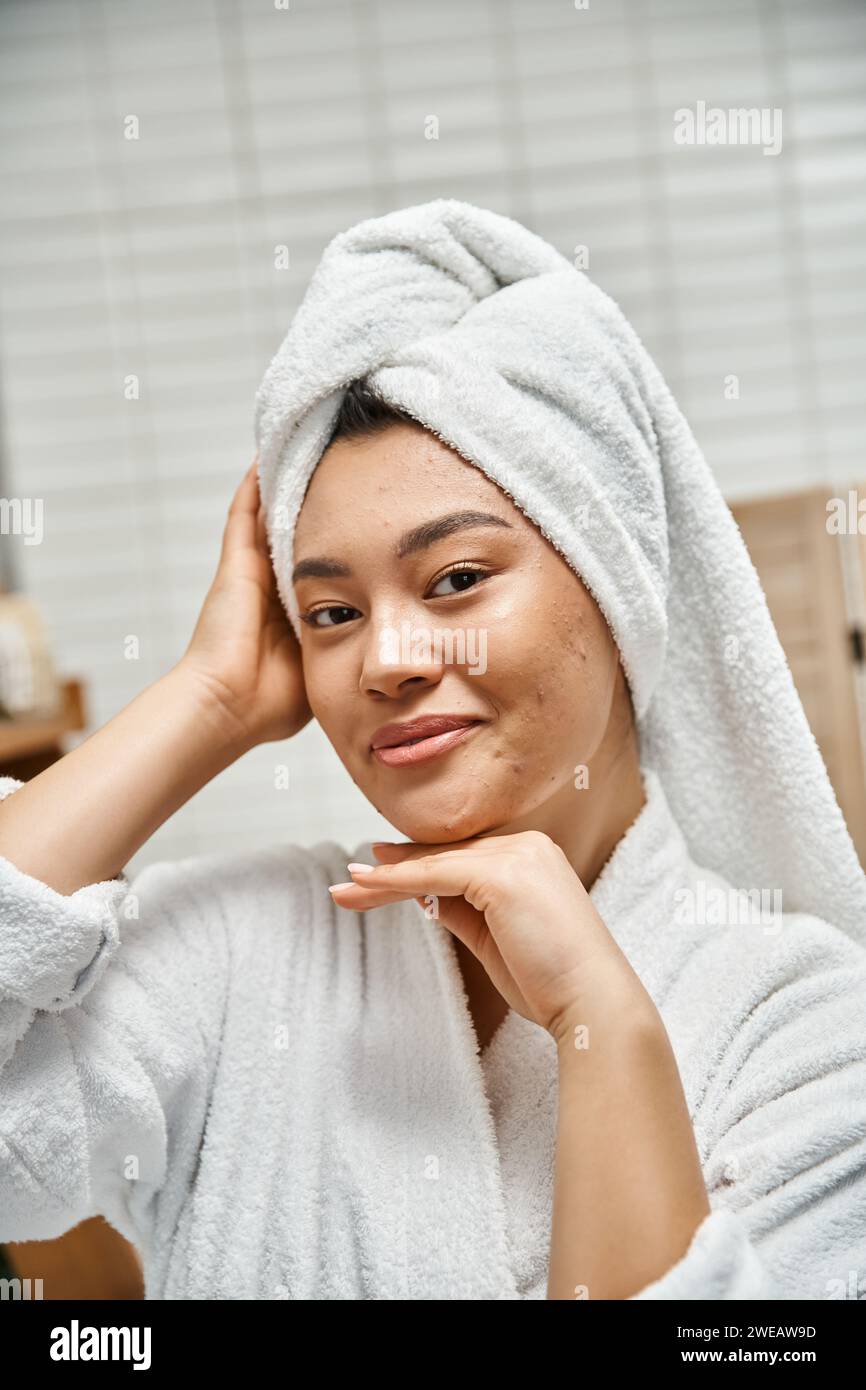 joyful asian woman with acne and white towel on head looking at camera