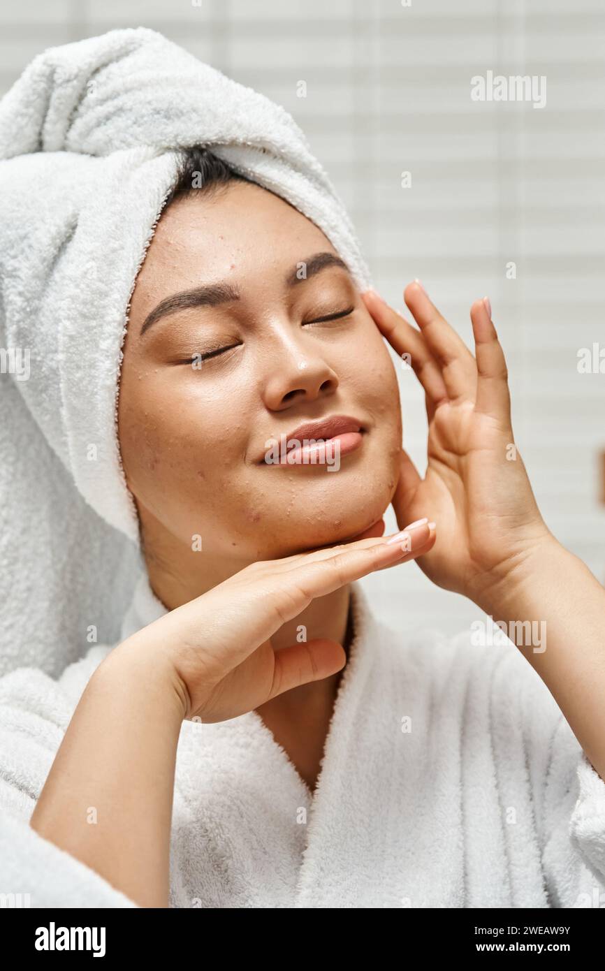 joyful asian woman with acne and white towel on head standing with