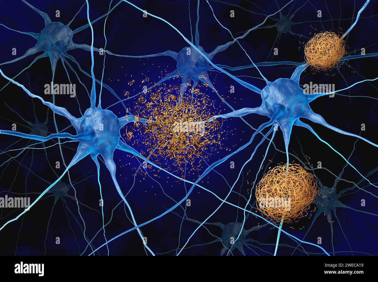 49 imágenes, fotos de stock, objetos en 3D y vectores sobre Amyloid ...
