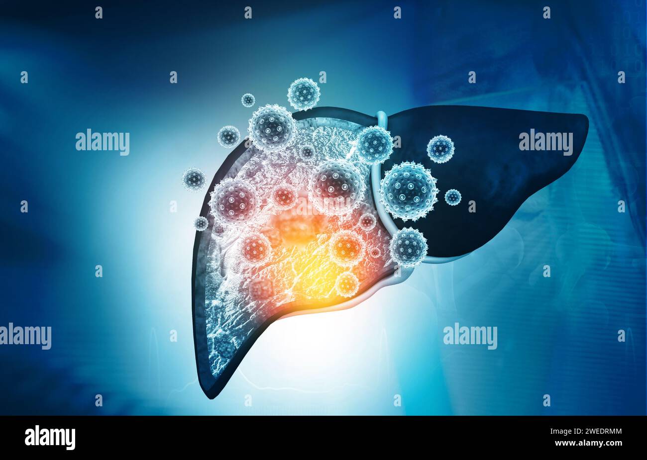 Virus attacks human liver. 3d illustration Stock Photo