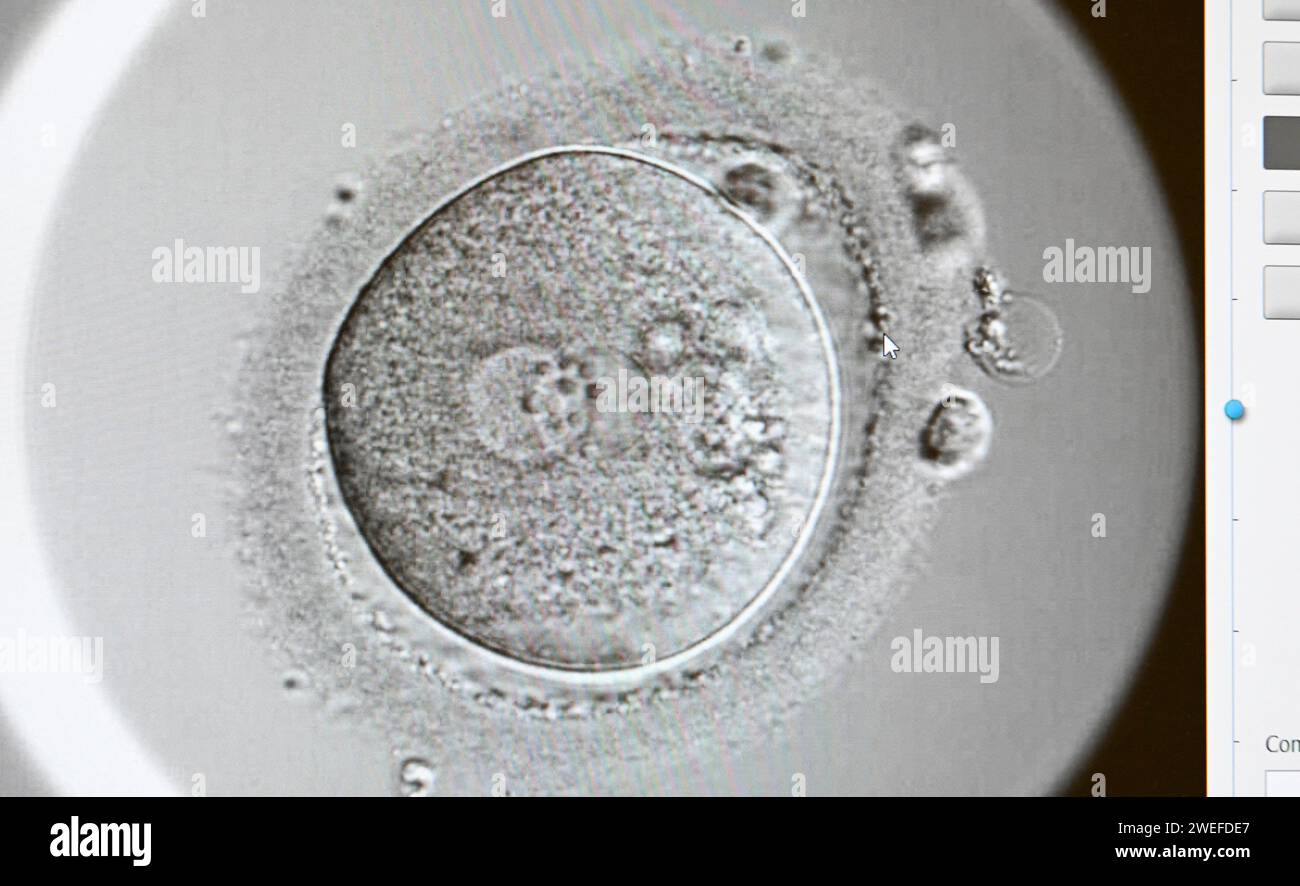 PRODUCTION - 17 January 2024, Berlin: In the cell laboratory at the Fertility Center Berlin, a two-cell organism can be seen on a screen after successful artificial insemination. Here, a paternal and maternal pronucleus fuse. Photo: Jens Kalaene/dpa Stock Photo