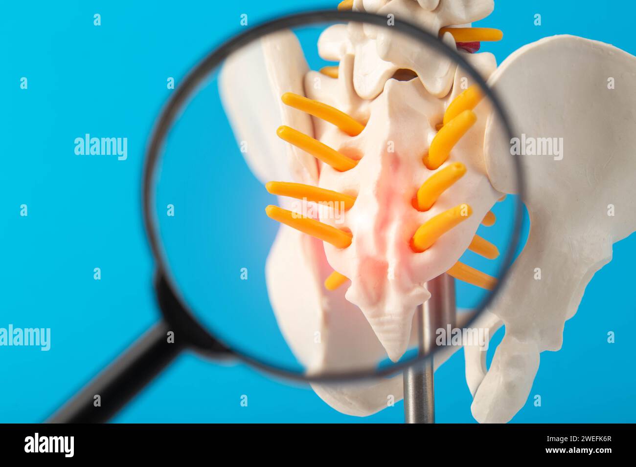 Coccyx and sacrum of the spine mockup on a blue background under a magnifying glass. Concept of degenerative spine diseases, injuries and back pain. L Stock Photo