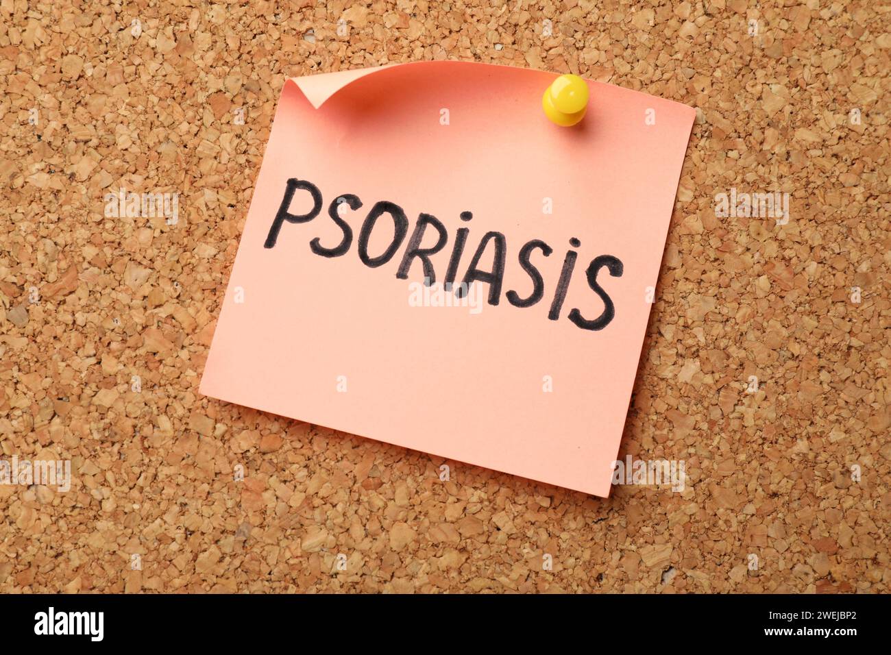 Psoriasis word hi-res stock photography and images - Alamy