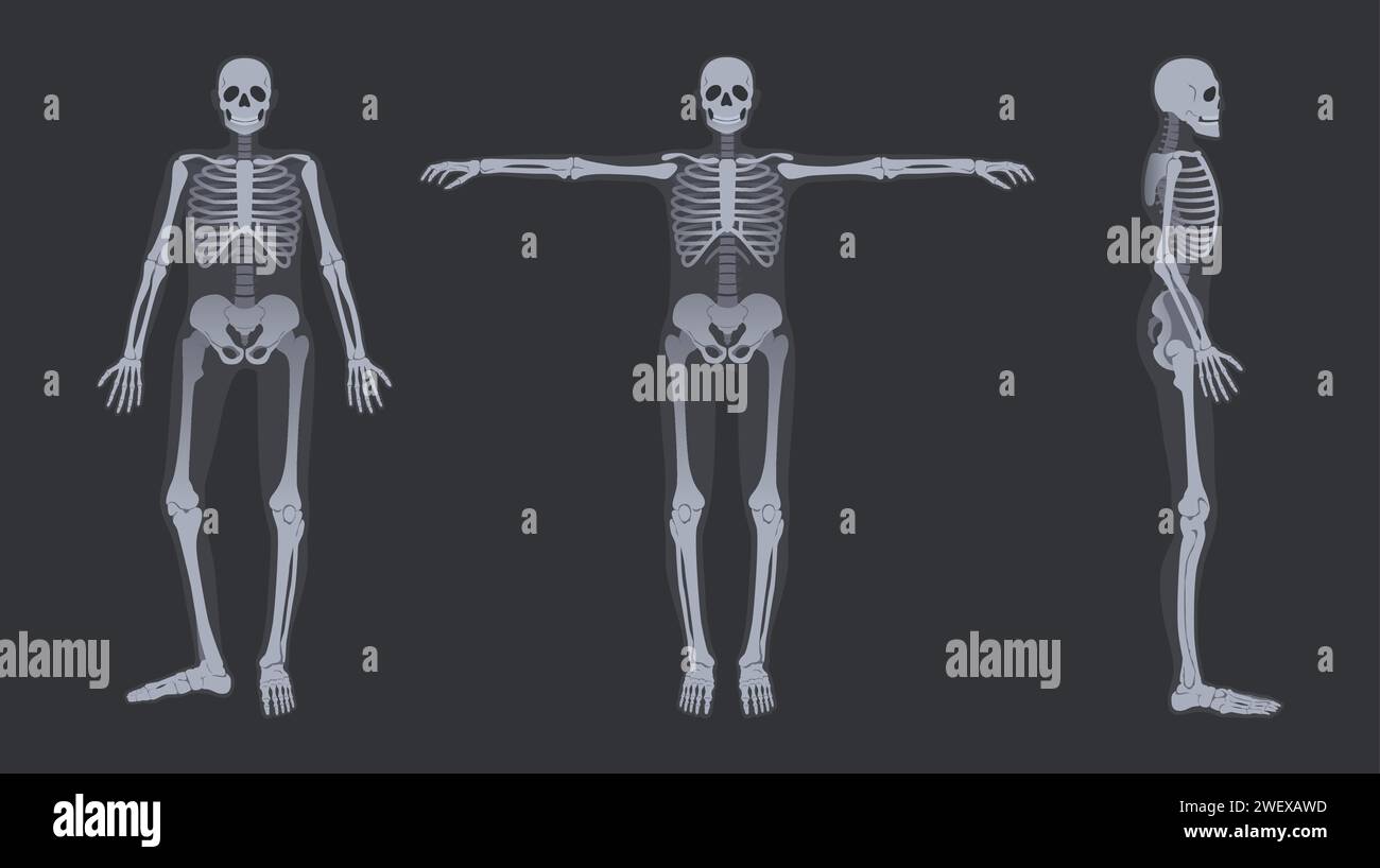 Human skeleton x-ray. Detailed radiology full-body bone structure anatomy poses, vector illustration set Stock Vector