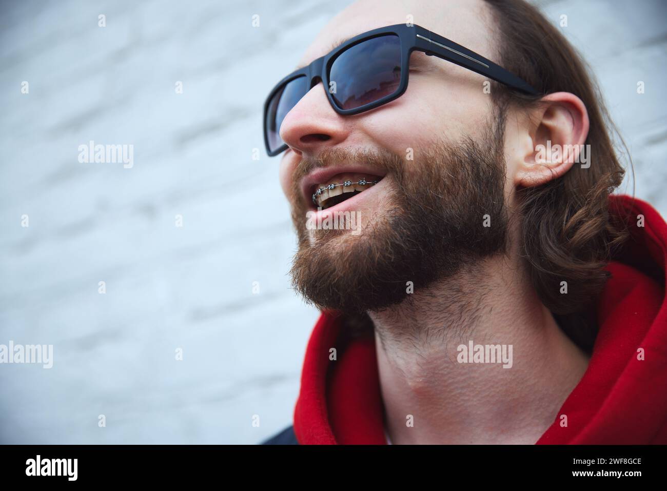 Close up photo of young bearded man with braces smiling with teeth ...