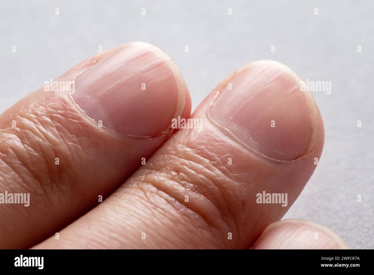 Lunula nails hi-res stock photography and images - Alamy