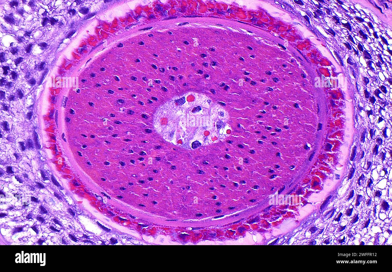 Hair follicle cross section, light micrograph Stock Photo - Alamy