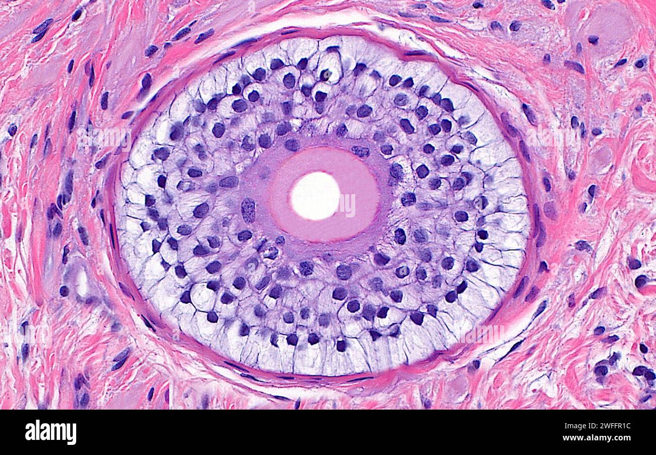 Hair follicle cross section, light micrograph Stock Photo - Alamy
