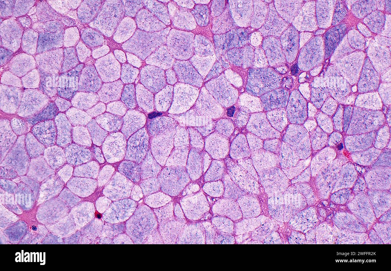Sinus respiratory epithelium cells, light micrograph Stock Photo - Alamy