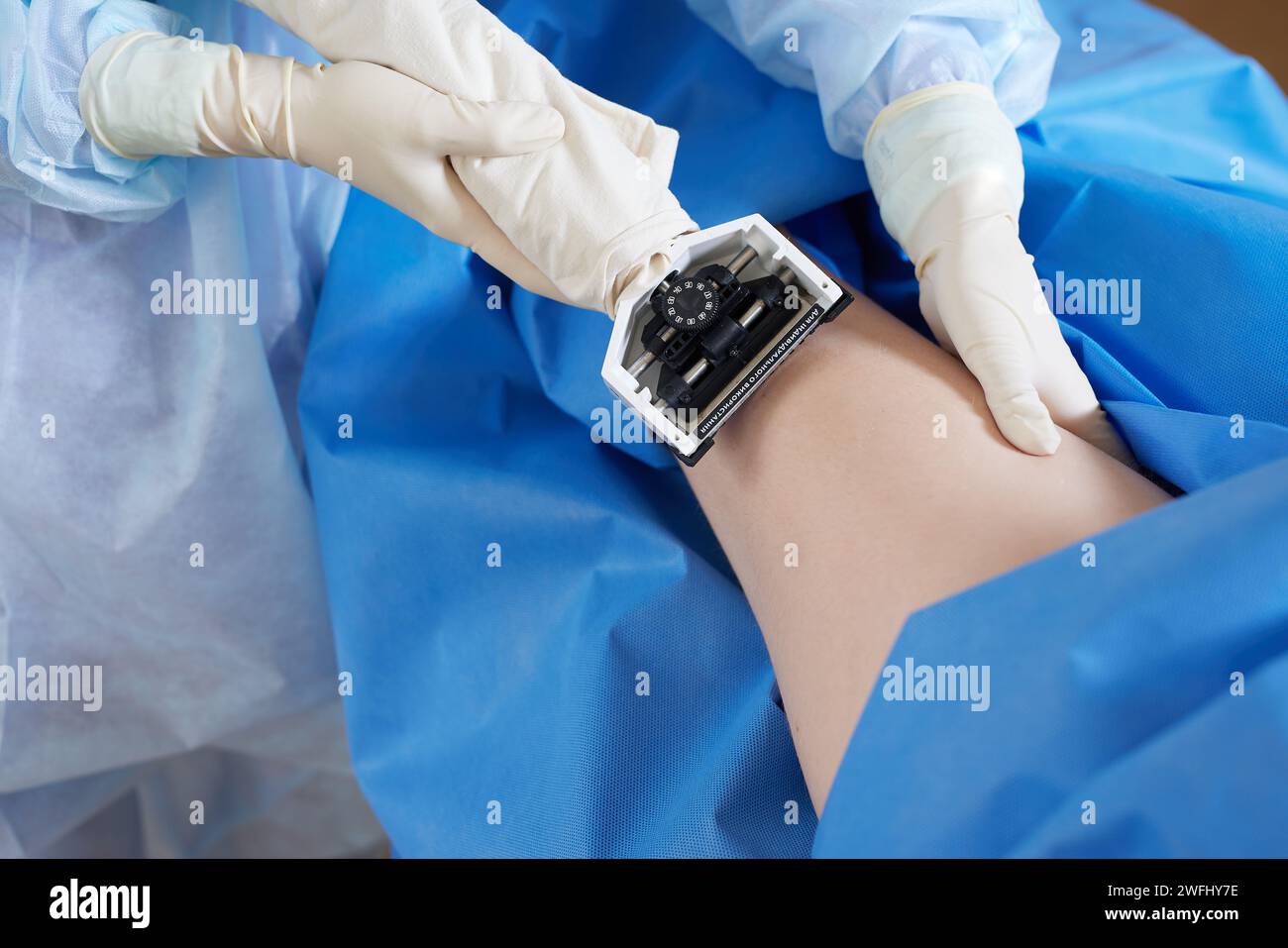 doctor performs skin graft in clinic or hospital, skin graft equipment Stock Photo
