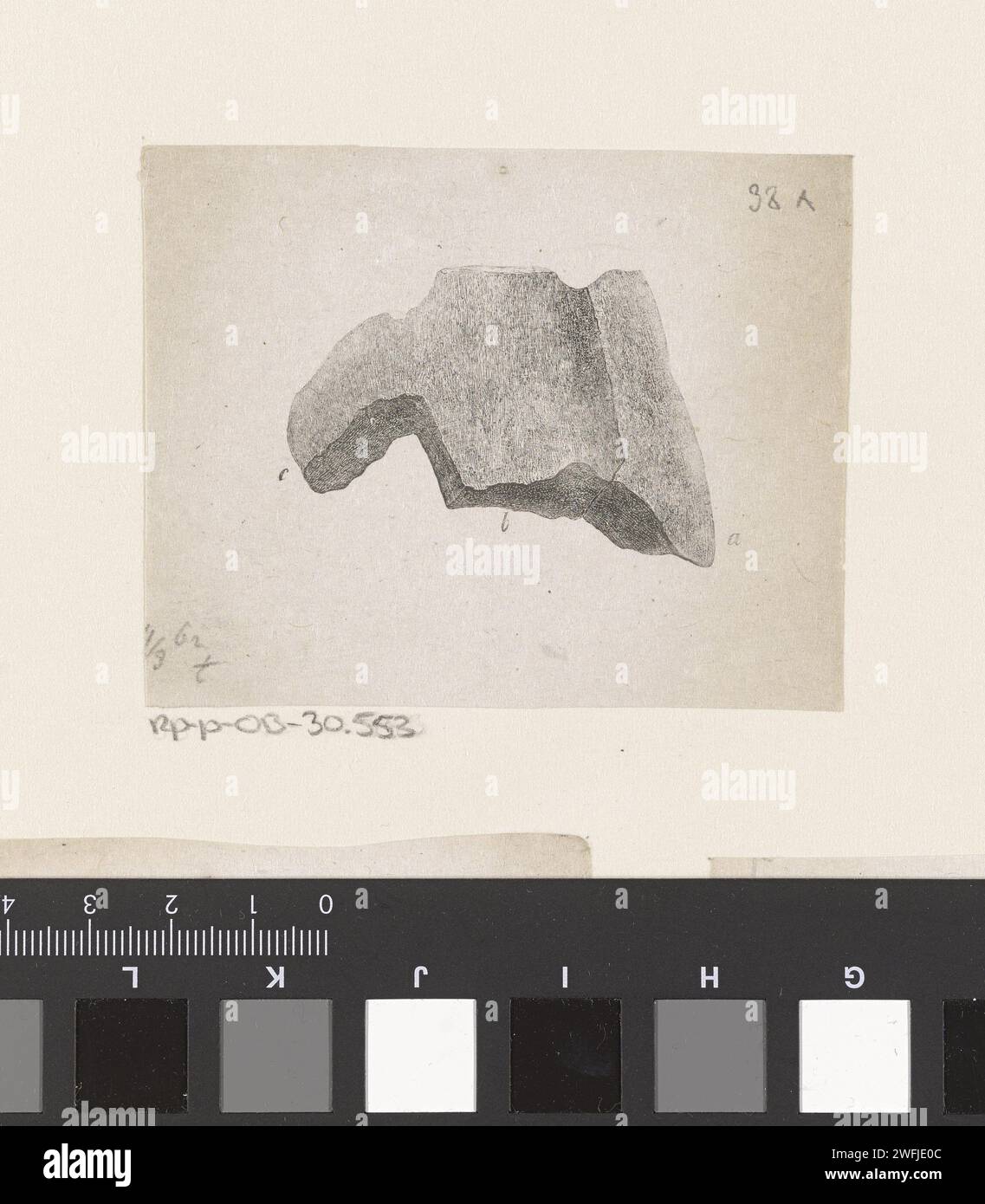 Part of the human body with a deviation, Isaac Weissenbruch, 1836 ...