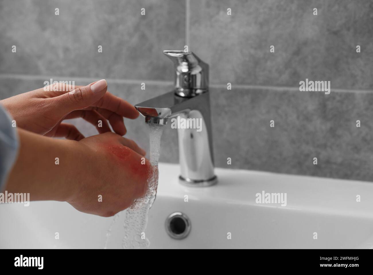 Woman holding burned hand under cold water indoors, closeup. Space for text Stock Photo Alamy