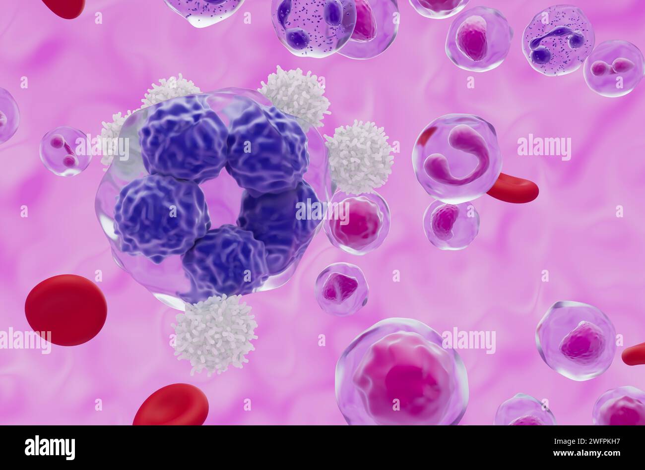 White blood cells with T-cell lymphoma - closeup view 3d illustration Stock Photo