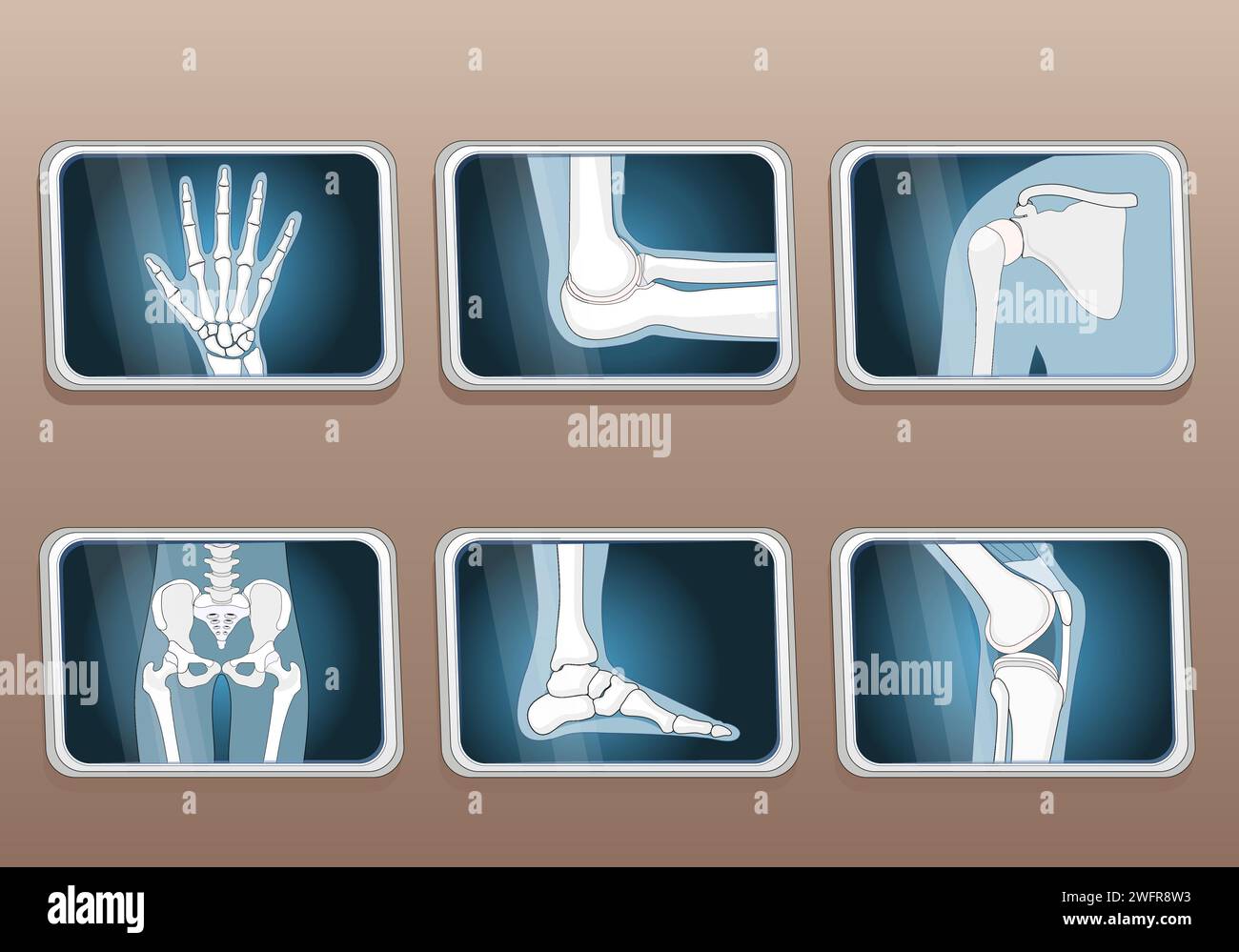 Types of joints. Knee, Elbow, wrist, hip, shoulder joints and Articulations of foot. Set icons. X-ray image. Isometric Flat vector illustration. Stock Vector