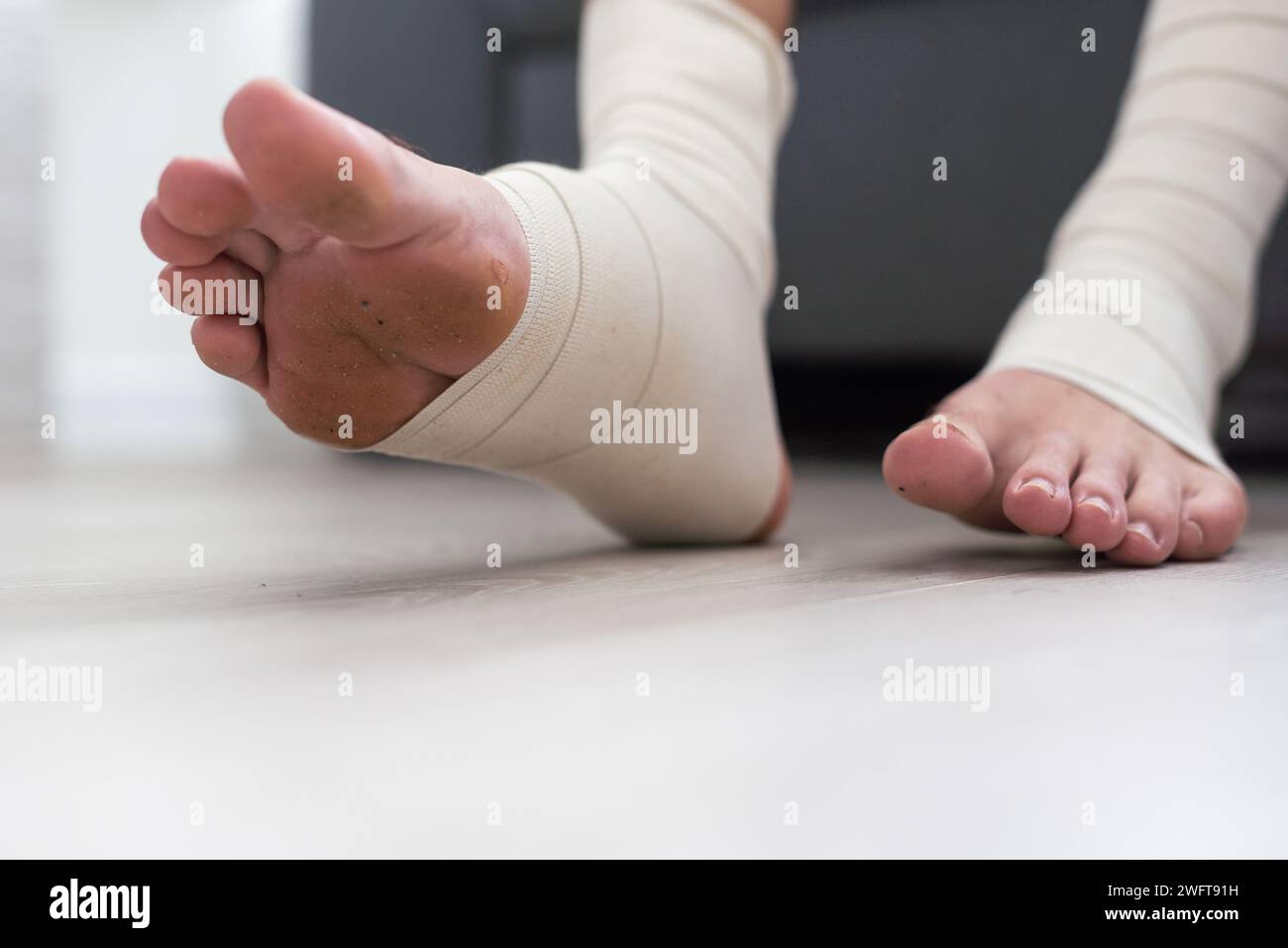 man using put on elastic bandage with legs having leg pain Stock Photo