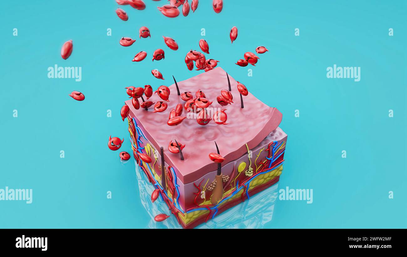 Computer Virus Skin Abstract illustration of the skin protection from the viruses Stock ...