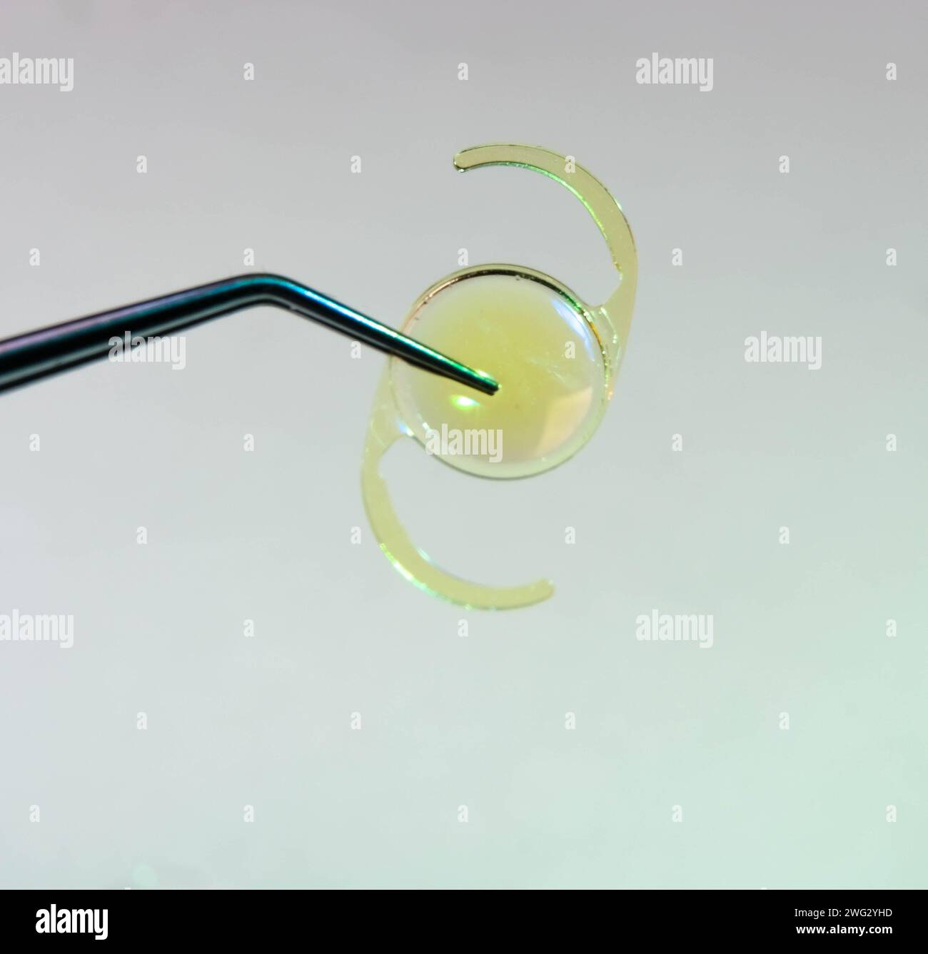 closeup photo of foldable itraocular lens for cataract surgery Stock