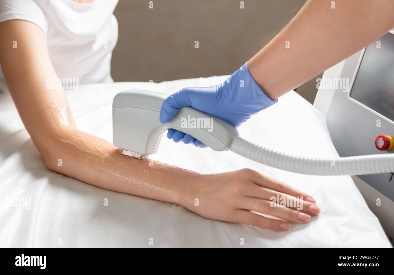 Laser hair removal of hands in a beauty salon. Hand hair removal