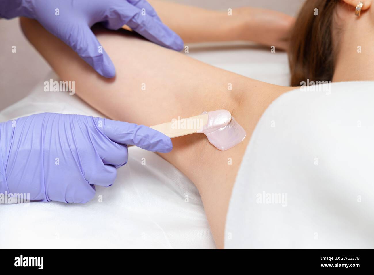 Armpit waxing procedure in a beauty salon. Master in gloves applies wax with a wooden spatula to a woman's armpit to remove hair. Body care concept. Stock Photo