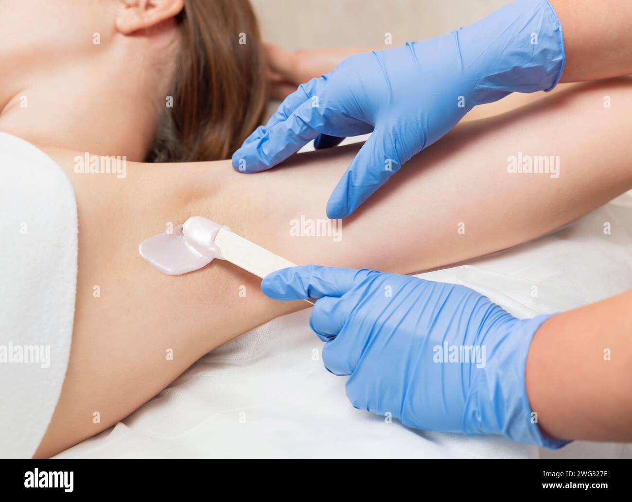 Armpit waxing procedure in a beauty salon. Master in gloves applies wax with a wooden spatula to a woman's armpit to remove hair. Stock Photo