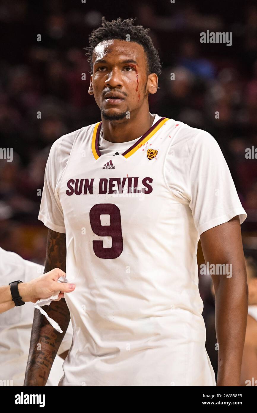 Arizona State Sun Devils center Shawn Phillips Jr. (9) leaves the game with an eye injury in the