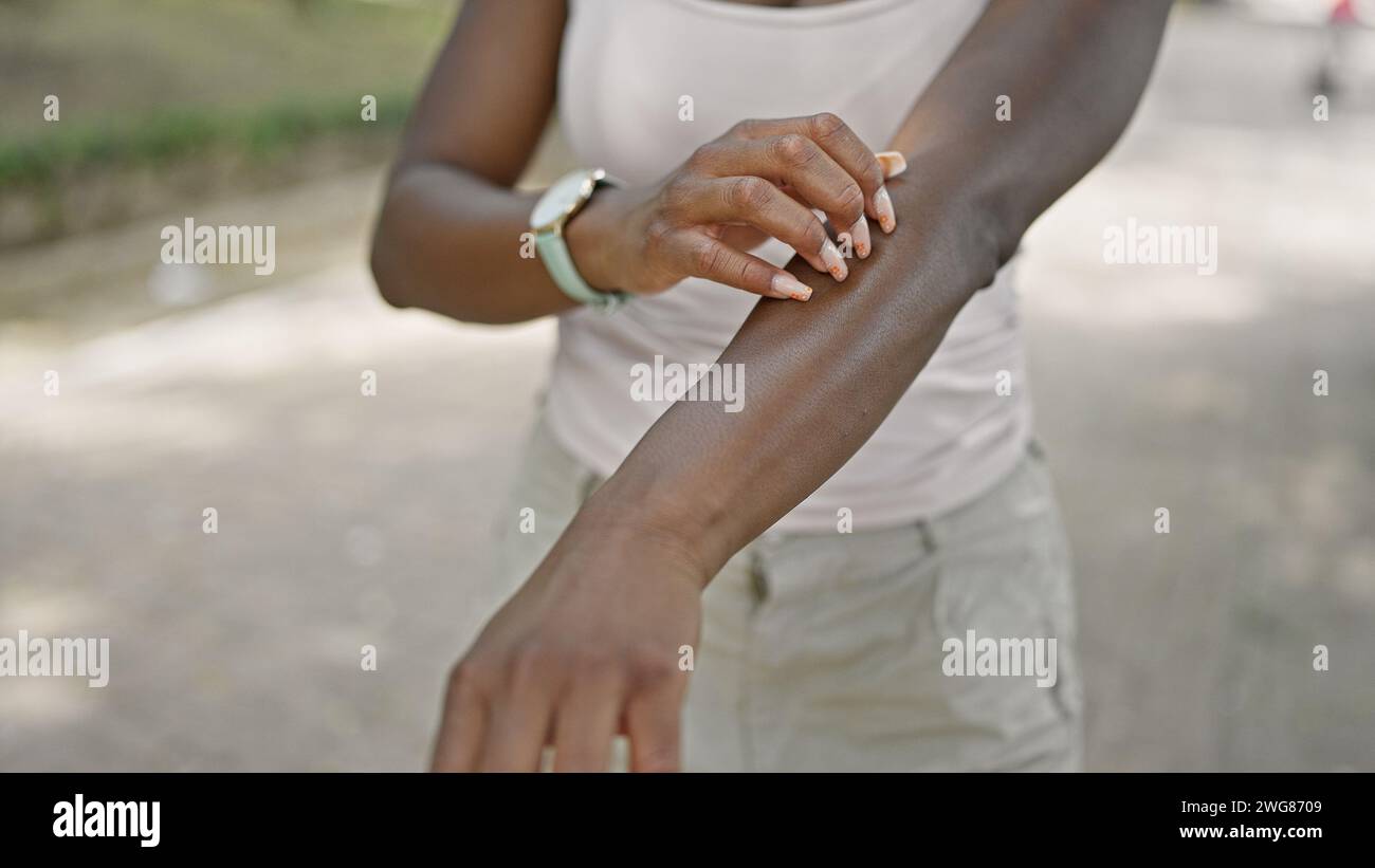Arm rash african american hi-res stock photography and images - Alamy