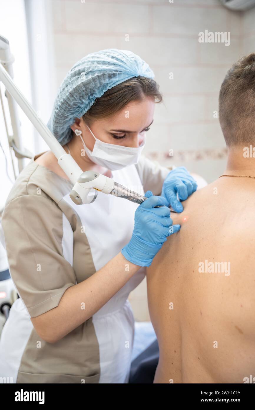 Dermatologist removes skin tumors with a laser, the process of removing skin diseases Stock Photo