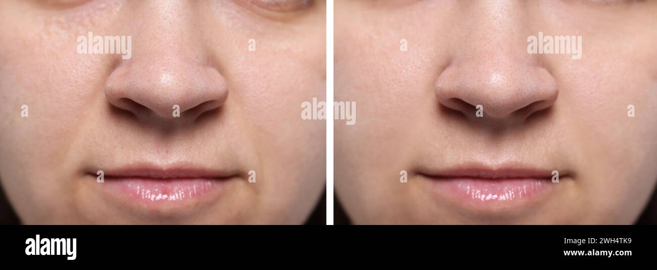Aging skin changes. Woman showing face before and after rejuvenation ...