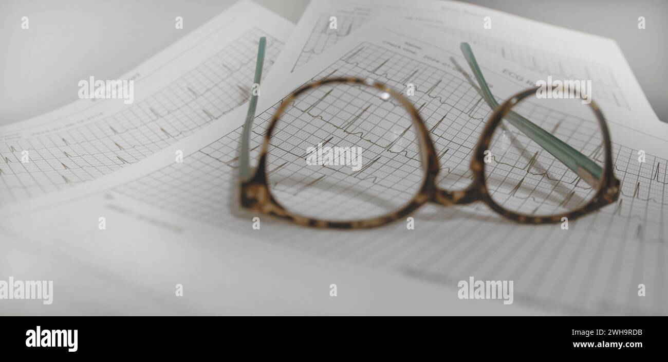 ECG EKG reports printed on sheets. A pair of reading glasses Stock Photo