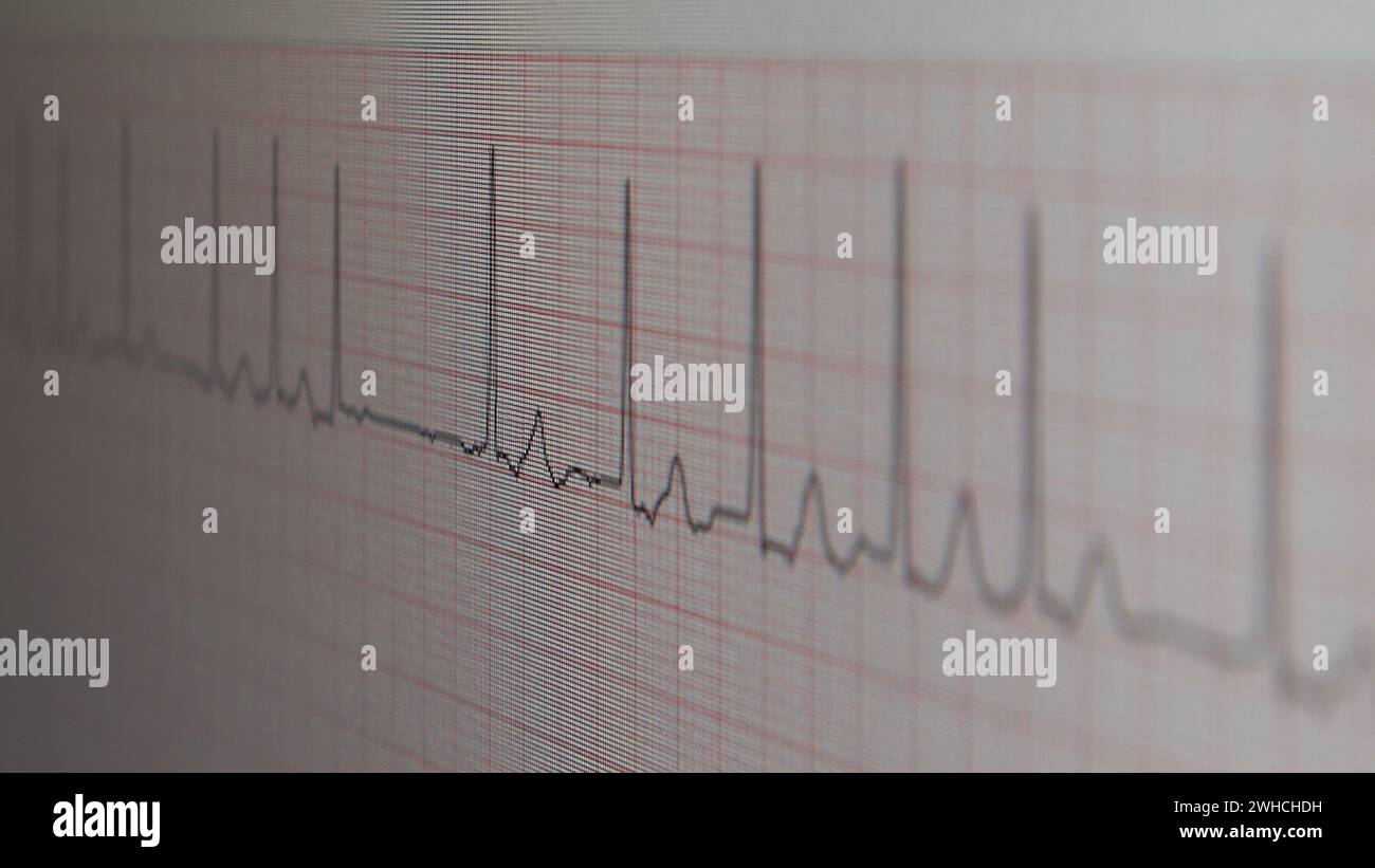 ECG EKG displayed on the LCD screen, close-up Stock Photo