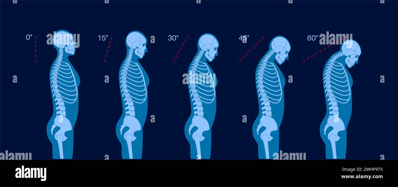 Vertebrae Head Diagram Hi Res Stock Photography And Images Alamy