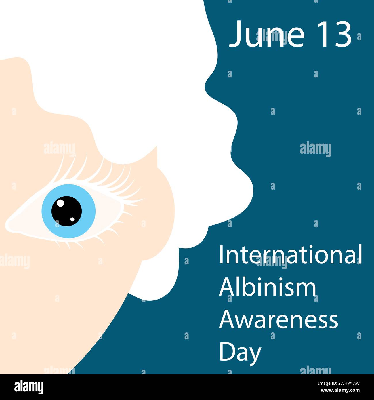 International Albinism Awareness Day. Blonde and eyes with white ...