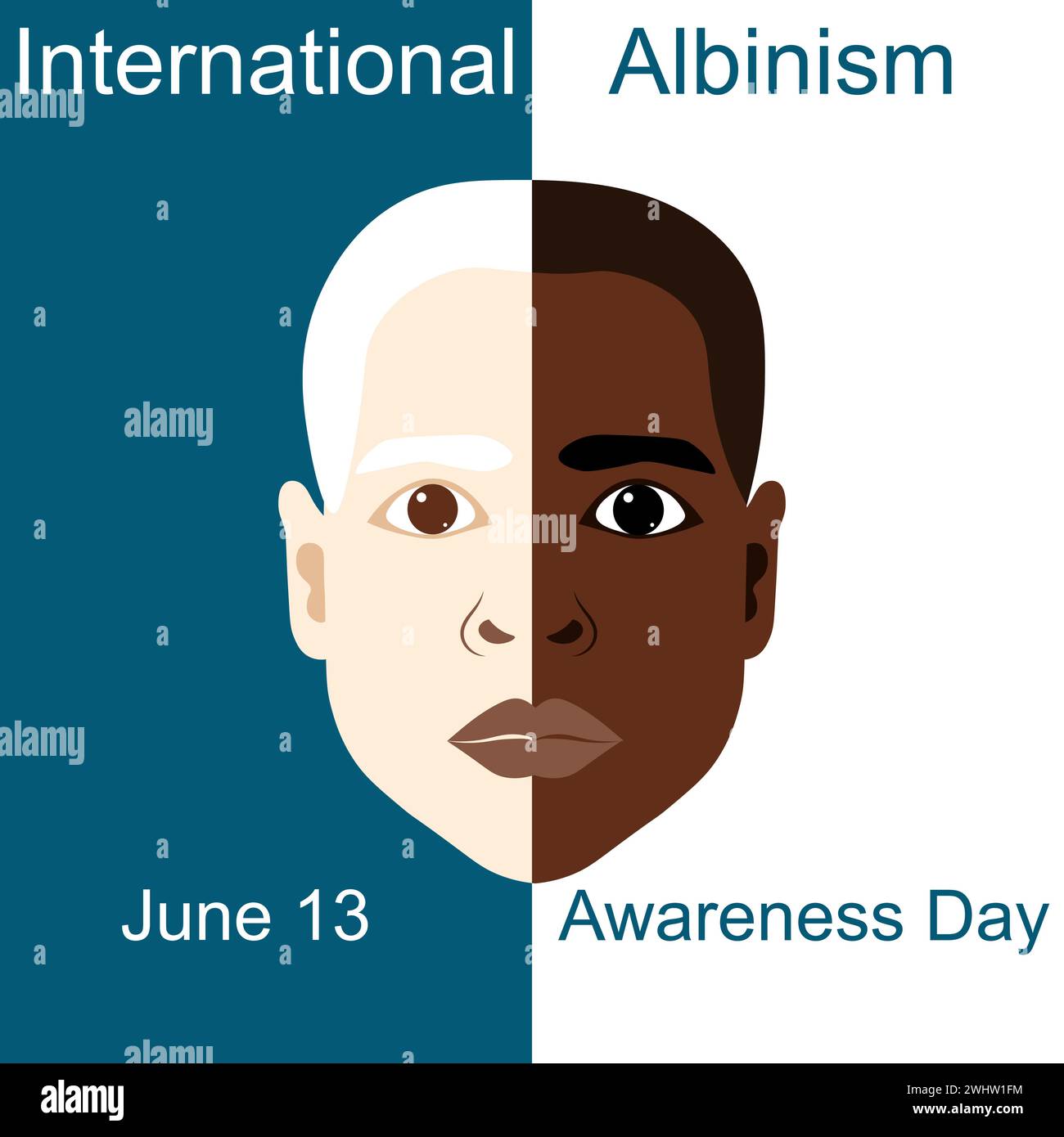 International Albinism Awareness Day. Black albino boy. Genetic rare ...