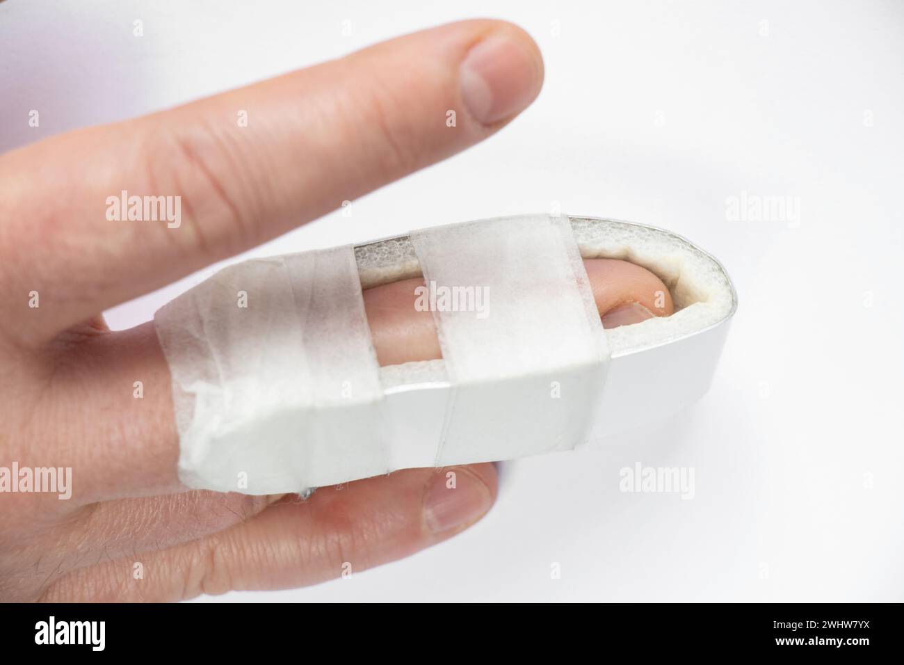 A man's hand with a broken finger and a splint placed on a broken finger on a white background, a broken finger, injury, accident, a man broke his fin Stock Photo