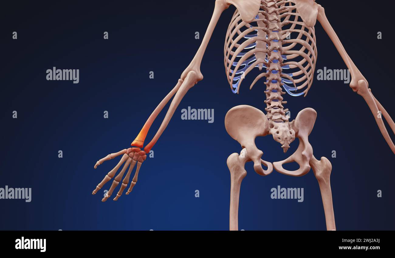 3d rendered illustration of a human skeleton with wrist pain Stock Photo