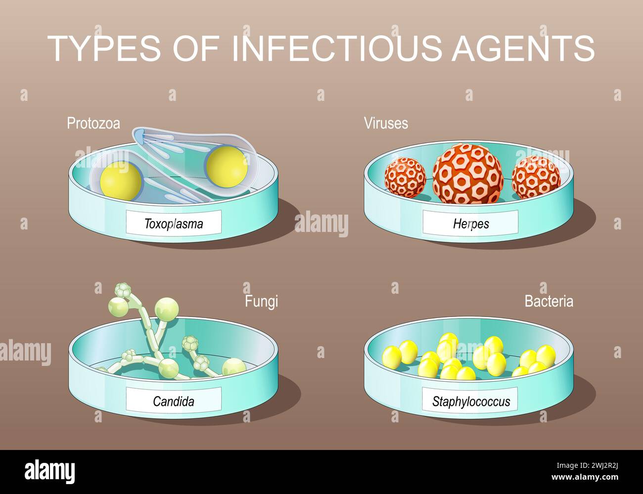 Types of infectious agents. pathogens. Parasitic protozoan. Viruses, bacteria, fungi and unicellular organism. Petri dishes with Candida albicans, her Stock Vector