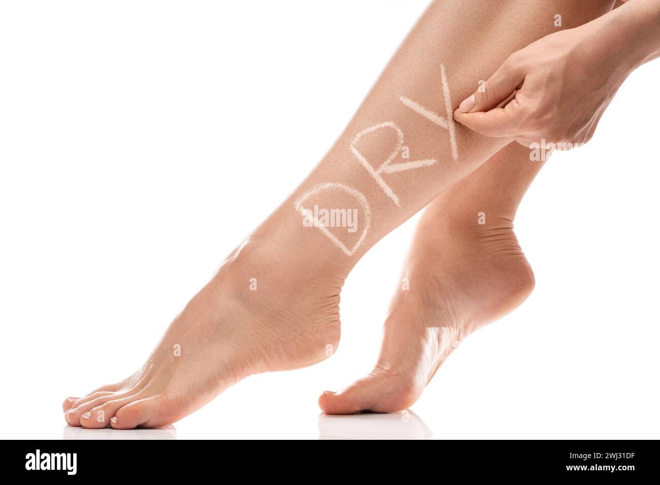 Female legs with itchy skin and DRY lettering on it Stock Photo Alamy