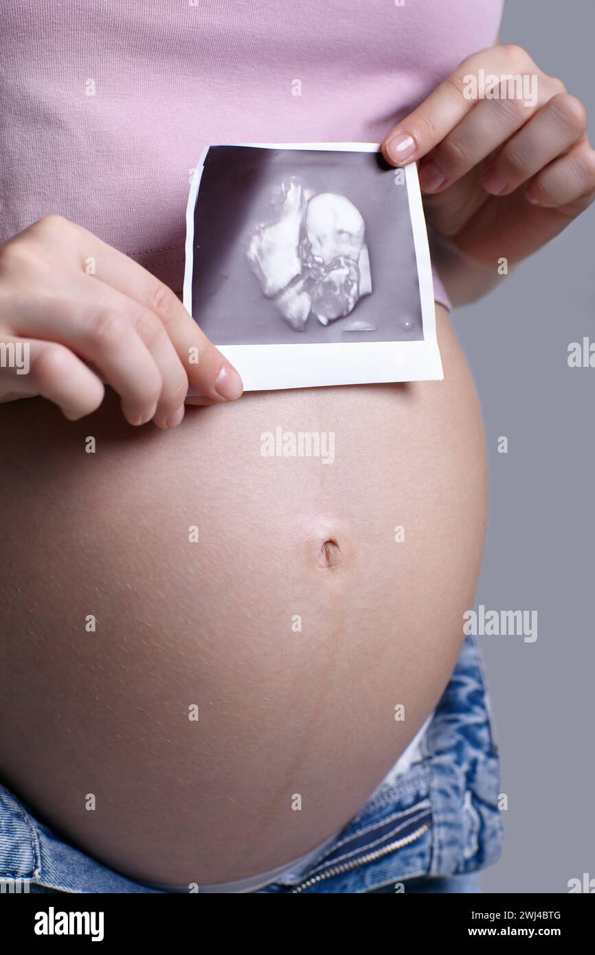 Pregnant female is holding sonogram baby embryo image over a pregnant belly. Stock Photo