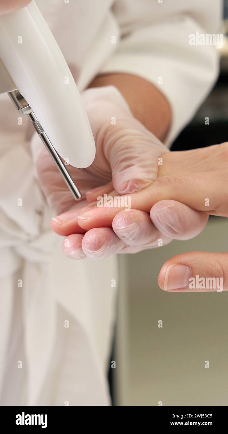 Laser treatment of nails in a beauty salon Stock Photo