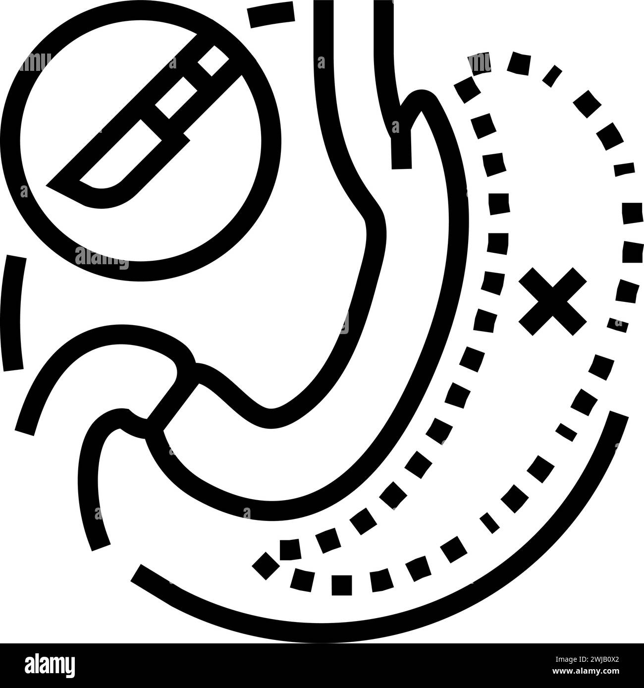 gastrectomy surgery doctor line icon vector illustration Stock Vector ...